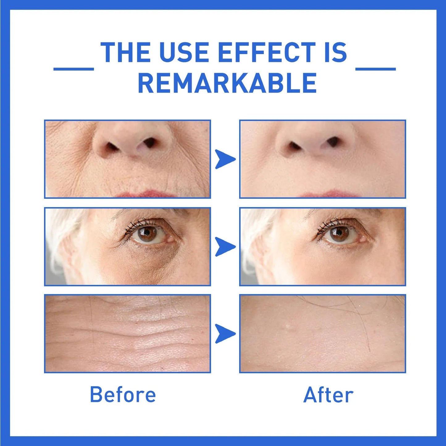Anti-aging kräm (kollagen)